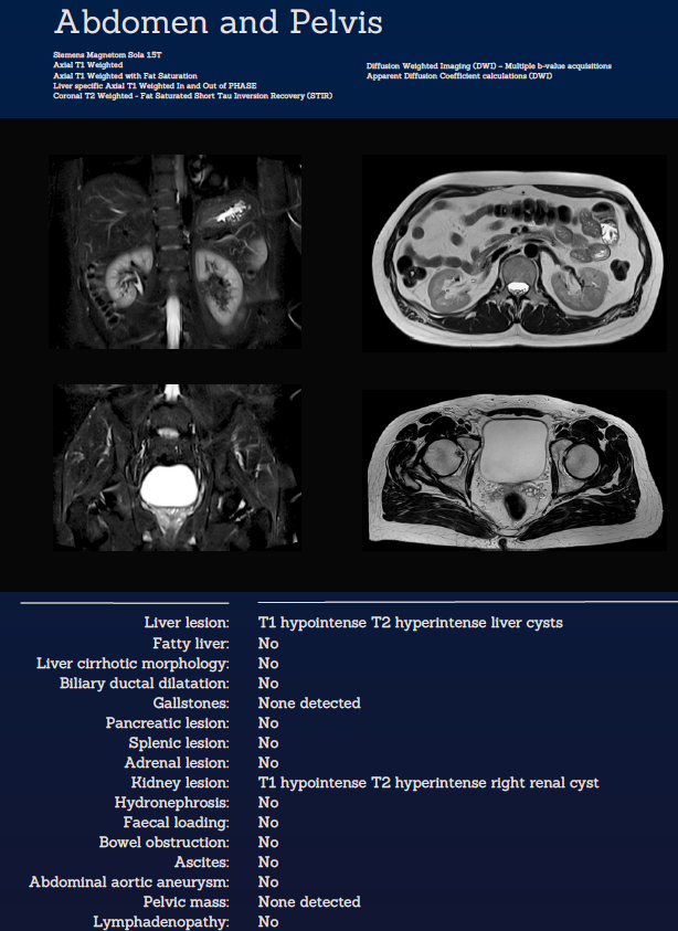 Whole Body MRI