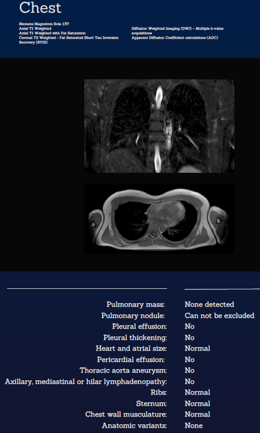 Whole Body MRI