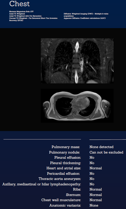 Whole Body MRI