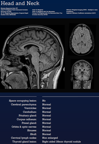 Whole Body MRI
