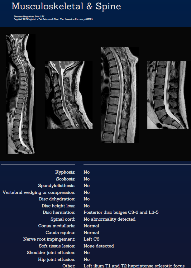 Whole Body MRI